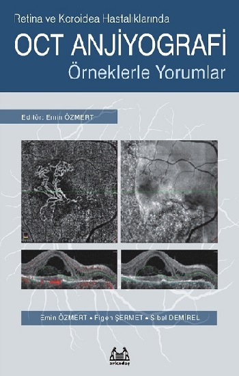 Retina ve Koroidea Hastalıklarında OCT Anjiyografi