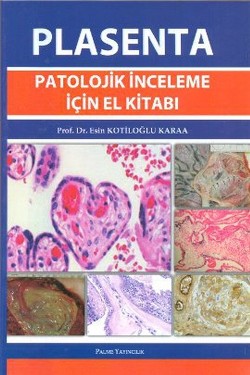 PLASENTA (PATOLOJİK İNCELEME İÇİN EL KİTABI)