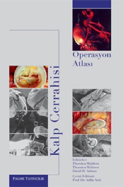 Kalp Cerrahisi Operasyon Atlası