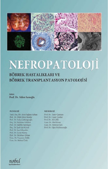 Nefropatoloji Böbrek Hastalıkları Ve Böbrek Transplantasyon